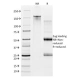 SDS-PAGE - Anti-CD28 Antibody [CB28] (PE) (A251156) - Antibodies.com
