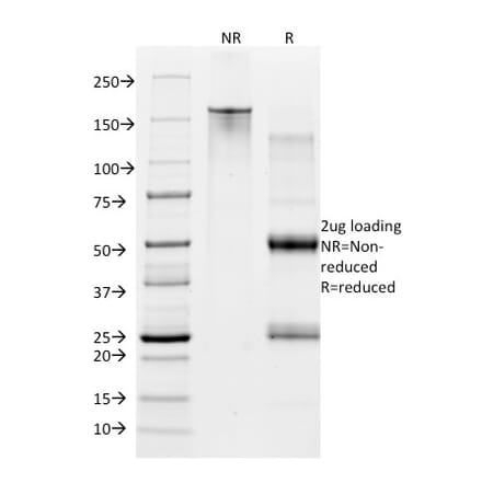 SDS-PAGE - Anti-CD28 Antibody [CB28] (CF® 488) (A251160) - Antibodies.com