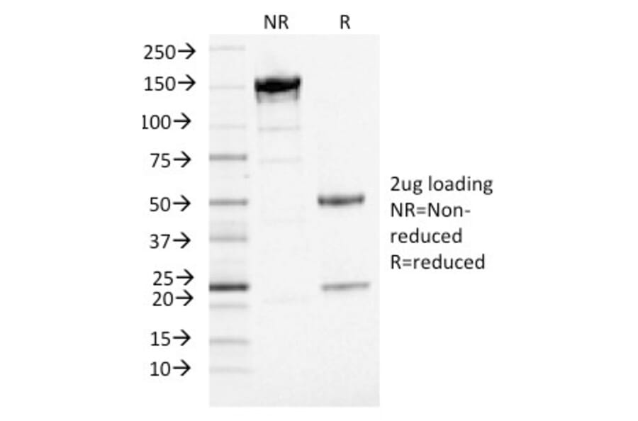 SDS-PAGE - Anti-PD-L1 Antibody [PDL1/2746] (PE) (A251181) - Antibodies.com