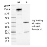 SDS-PAGE - Anti-PD-L1 Antibody [PDL1/2746] (PE) (A251181) - Antibodies.com