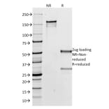 SDS-PAGE - Anti-Human IgG Heavy Chain Antibody [IG266] (CF® 488) (A251186) - Antibodies.com