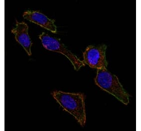 Immunofluorescence - Anti-EpCAM Antibody [EGP40/826] (CF® 488) (A251186) - Antibodies.com
