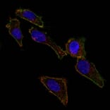 Immunofluorescence - Anti-EpCAM Antibody [EGP40/826] (CF® 488) (A251186) - Antibodies.com