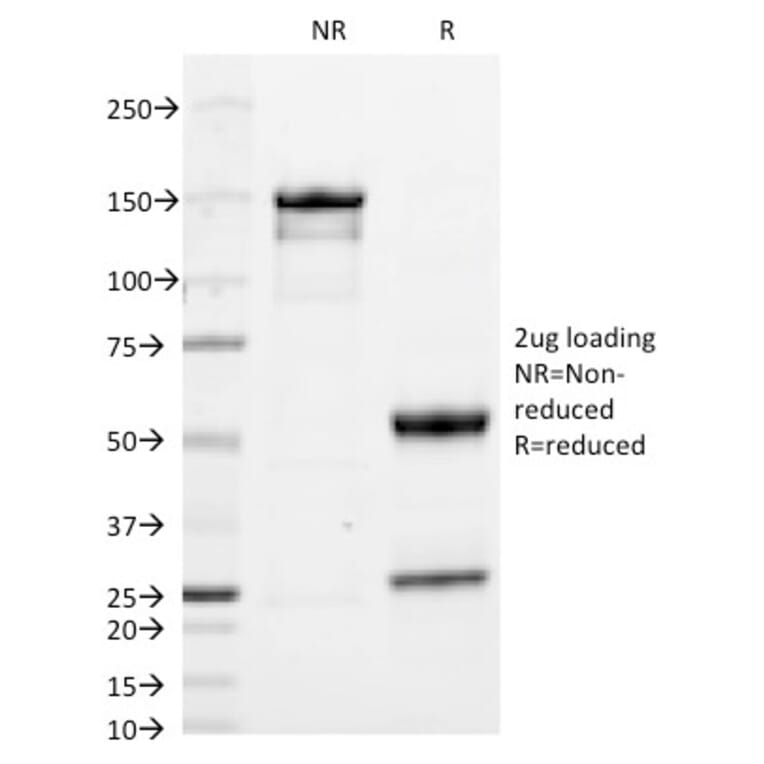 SDS-PAGE - Anti-Human IgA Heavy Chain Antibody [IA761] (CF® 488) (A252115) - Antibodies.com