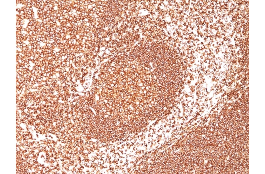 Immunohistochemistry - Anti-CD45 Antibody [2B11 + PD7/26] (FITC) (A251204) - Antibodies.com