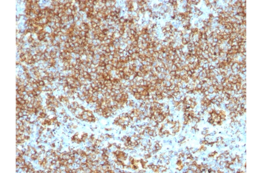 Immunohistochemistry - Anti-CD45 Antibody [SPM569 + SPM570] (FITC) (A251207) - Antibodies.com