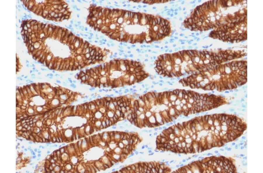 Immunohistochemistry - Anti-EpCAM Antibody [VU-1D9] (Biotin) (A251210) - Antibodies.com