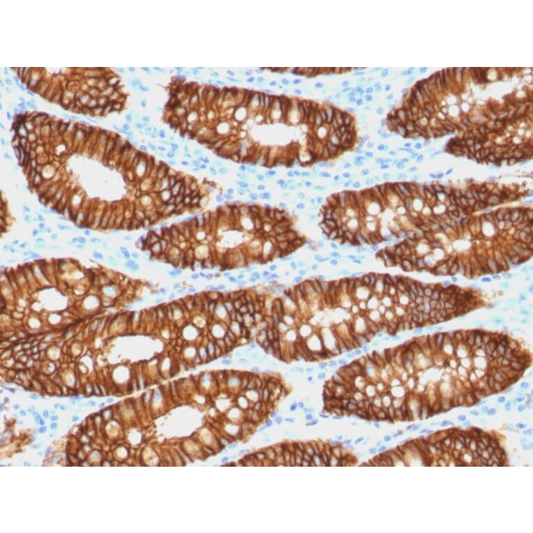 Immunohistochemistry - Anti-EpCAM Antibody [VU-1D9] (Biotin) (A251210) - Antibodies.com