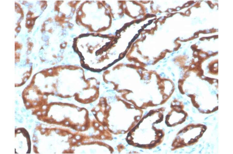 Immunohistochemistry - Anti-Cadherin 16 Antibody [CDH16/2125] (Biotin) (A251213) - Antibodies.com