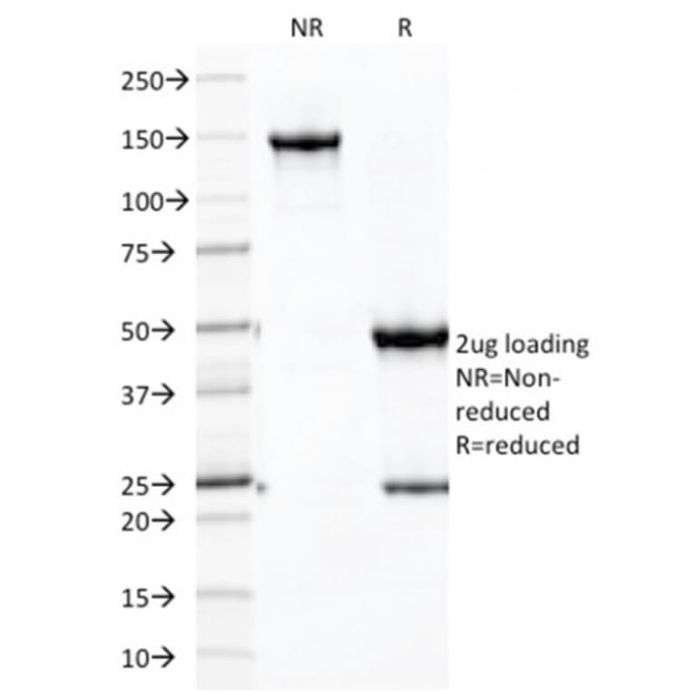 SDS-PAGE - Anti-Cadherin 16 Antibody [CDH16/2125] (Biotin) (A251213) - Antibodies.com