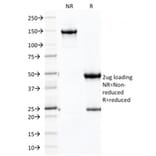 SDS-PAGE - Anti-Cadherin 16 Antibody [CDH16/2125] (Biotin) (A251213) - Antibodies.com