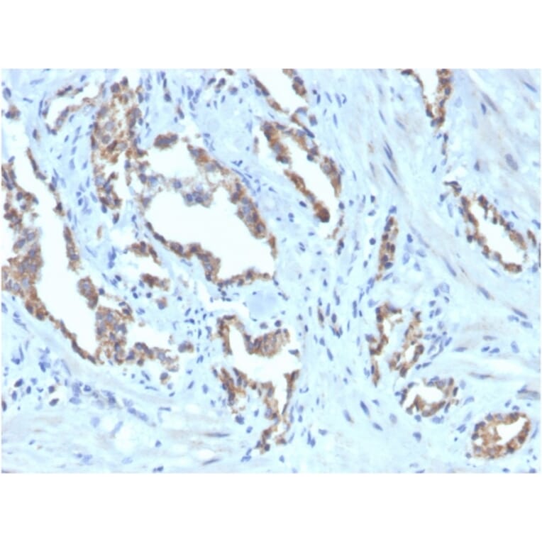 Immunohistochemistry - Anti-TIGIT Antibody [TIGIT/3106] (Biotin) (A251215) - Antibodies.com