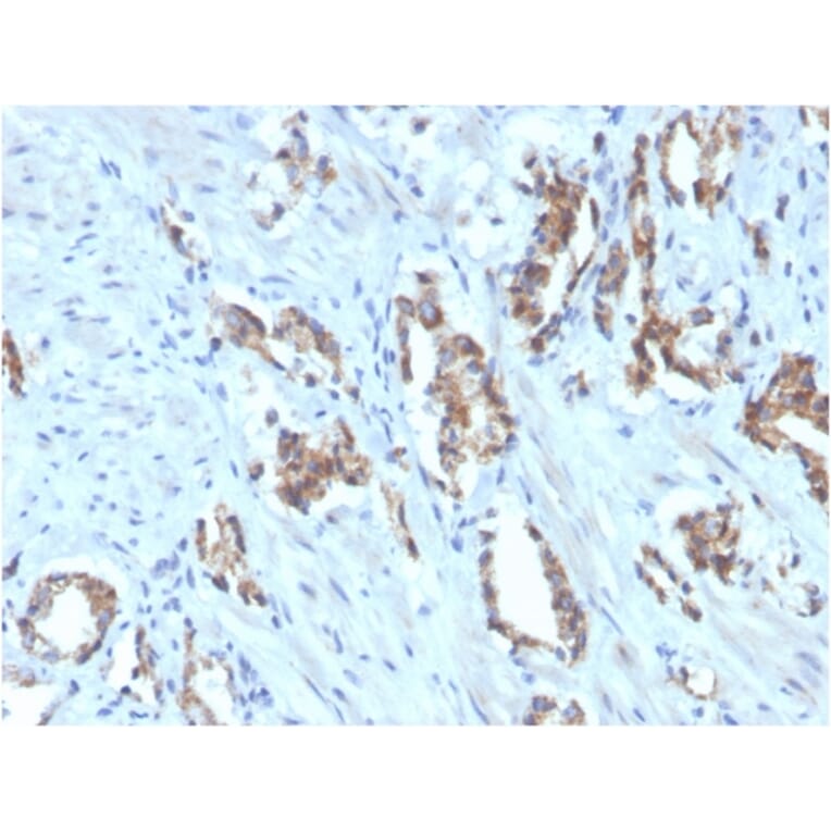 Immunohistochemistry - Anti-TIGIT Antibody [TIGIT/3106] (Biotin) (A251215) - Antibodies.com