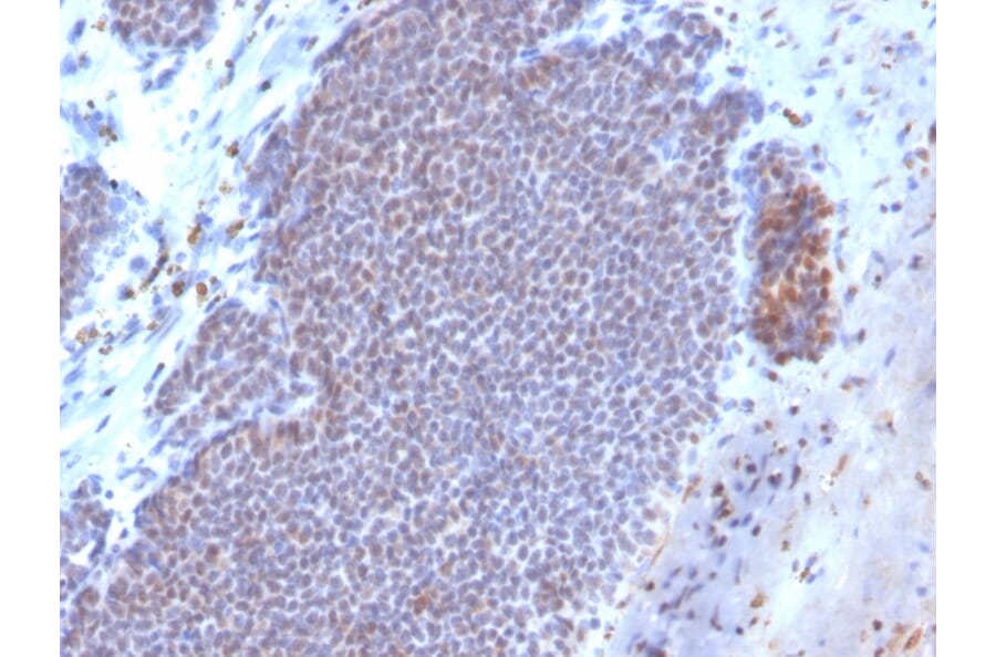 Immunohistochemistry - Anti-Estrogen Receptor alpha Antibody [ESR1/3373] (Biotin) (A251216) - Antibodies.com