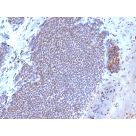 Immunohistochemistry - Anti-Estrogen Receptor alpha Antibody [ESR1/3373] (Biotin) (A251216) - Antibodies.com