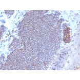 Immunohistochemistry - Anti-Estrogen Receptor alpha Antibody [ESR1/3373] (Biotin) (A251216) - Antibodies.com