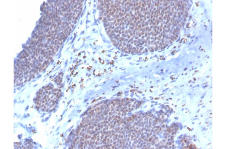 Immunohistochemistry - Anti-Estrogen Receptor alpha Antibody [ESR1/3373] (Biotin) (A251216) - Antibodies.com
