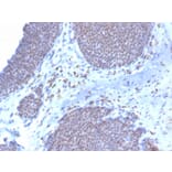 Immunohistochemistry - Anti-Estrogen Receptor alpha Antibody [ESR1/3373] (Biotin) (A251216) - Antibodies.com