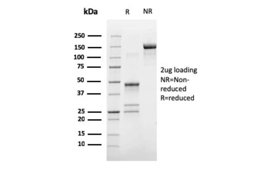 SDS-PAGE - Anti-Estrogen Receptor alpha Antibody [ESR1/3373] (Biotin) (A251216) - Antibodies.com