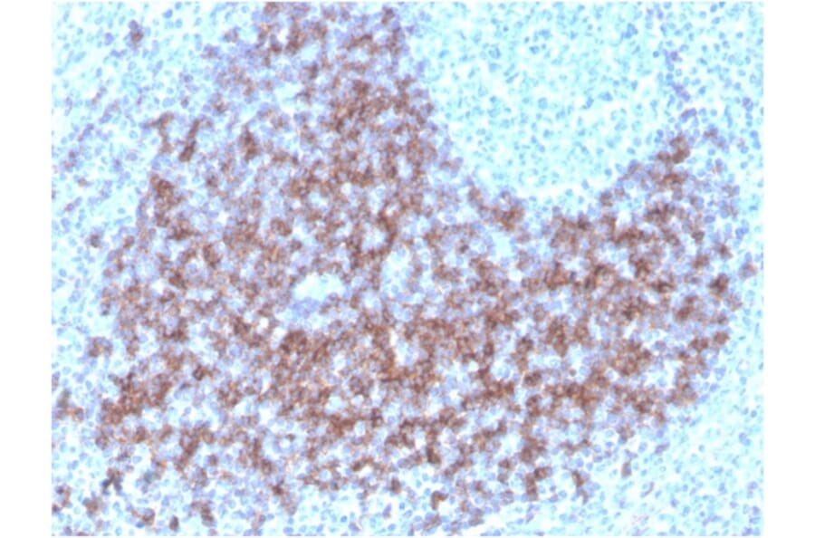 Immunohistochemistry - Anti-CD23 Antibody [FCER2/3592] (Biotin) (A251217) - Antibodies.com