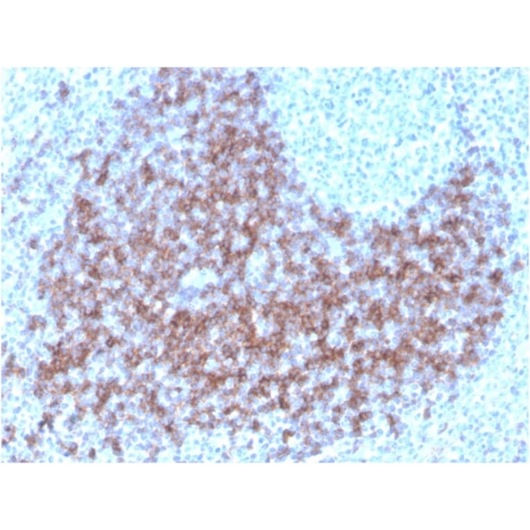 Immunohistochemistry - Anti-CD23 Antibody [FCER2/3592] (Biotin) (A251217) - Antibodies.com