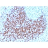 Immunohistochemistry - Anti-CD23 Antibody [FCER2/3592] (Biotin) (A251217) - Antibodies.com