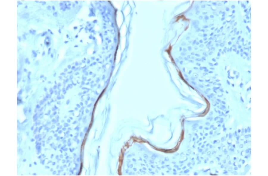 Immunohistochemistry - Anti-Filaggrin Antibody [FLG/1563] (Biotin) (A251218) - Antibodies.com