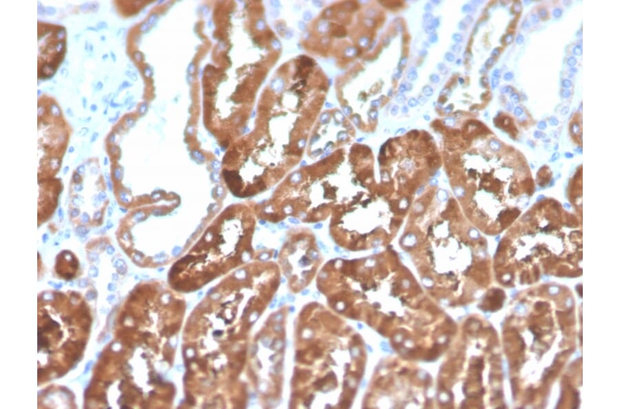 Immunohistochemistry - Anti-Ferritin Light Chain Antibody [FTL/1386] (Biotin) (A251219) - Antibodies.com