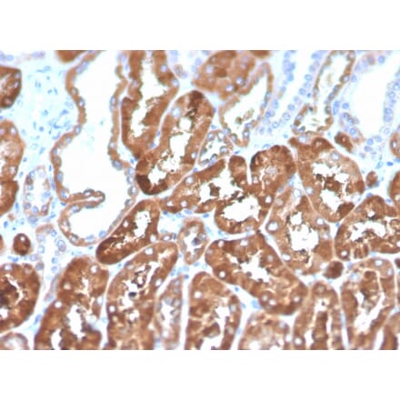 Immunohistochemistry - Anti-Ferritin Light Chain Antibody [FTL/1386] (Biotin) (A251219) - Antibodies.com