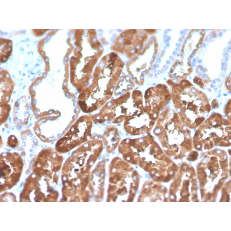 Immunohistochemistry - Anti-Ferritin Light Chain Antibody [FTL/1386] (Biotin) (A251219) - Antibodies.com