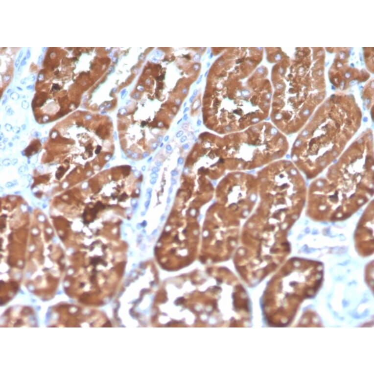 Immunohistochemistry - Anti-Ferritin Light Chain Antibody [FTL/1386] (Biotin) (A251219) - Antibodies.com