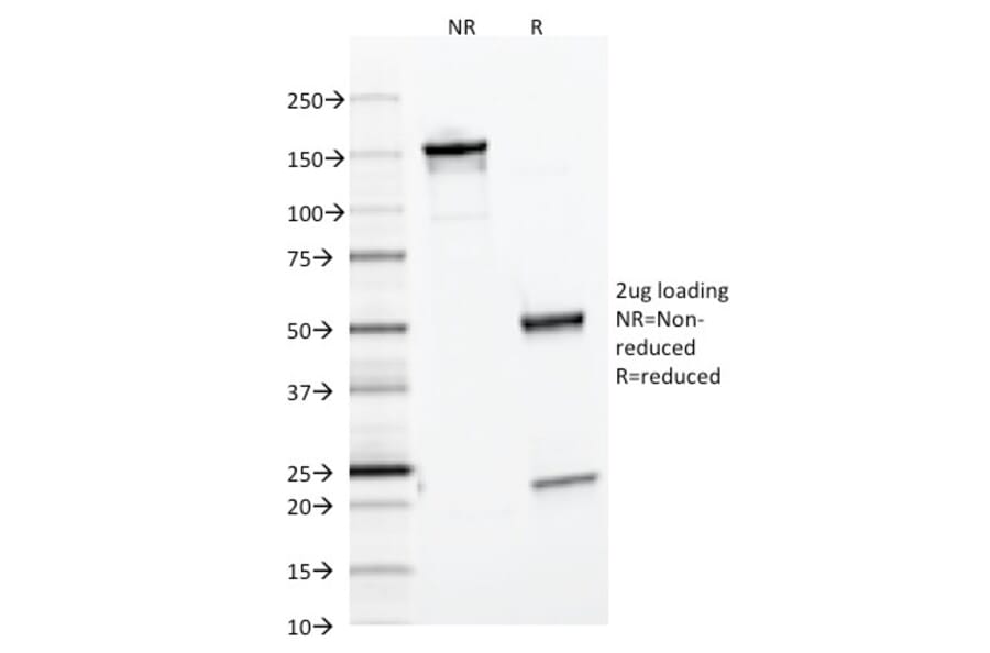 SDS-PAGE - Anti-Ferritin Light Chain Antibody [FTL/1386] (Biotin) (A251219) - Antibodies.com