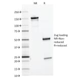 SDS-PAGE - Anti-Ferritin Light Chain Antibody [FTL/1386] (Biotin) (A251219) - Antibodies.com