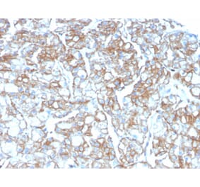 Immunohistochemistry - Anti-PD-L1 Antibody [PDL1/2746] (Biotin) (A251220) - Antibodies.com