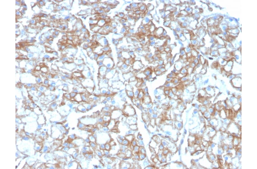Immunohistochemistry - Anti-PD-L1 Antibody [PDL1/2746] (Biotin) (A251220) - Antibodies.com