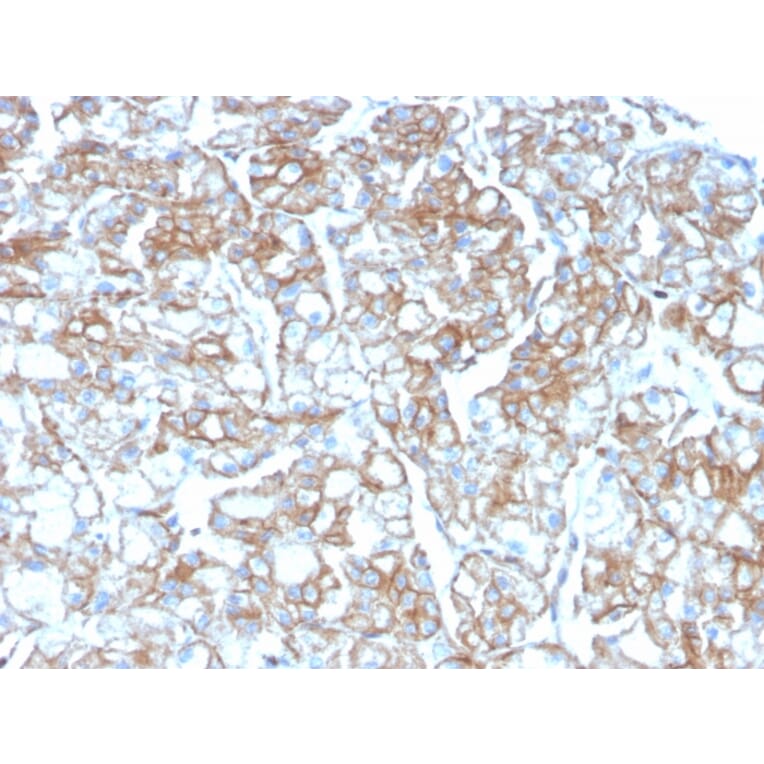 Immunohistochemistry - Anti-PD-L1 Antibody [PDL1/2746] (Biotin) (A251220) - Antibodies.com