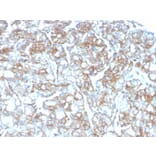 Immunohistochemistry - Anti-PD-L1 Antibody [PDL1/2746] (Biotin) (A251220) - Antibodies.com