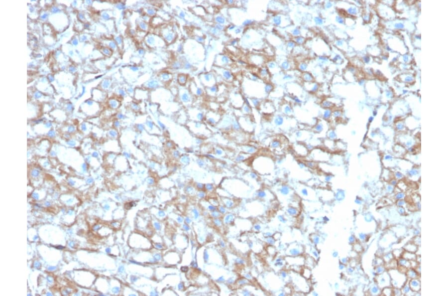 Immunohistochemistry - Anti-PD-L1 Antibody [PDL1/2746] (Biotin) (A251220) - Antibodies.com