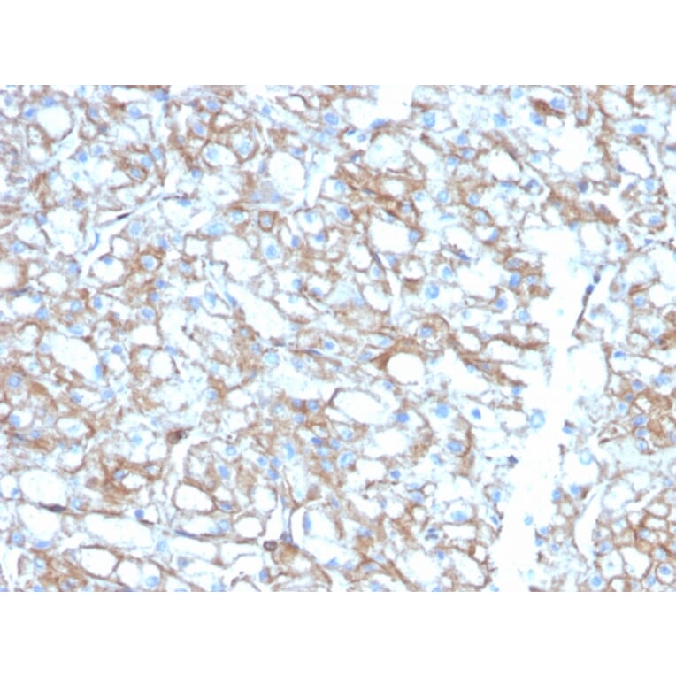 Immunohistochemistry - Anti-PD-L1 Antibody [PDL1/2746] (Biotin) (A251220) - Antibodies.com