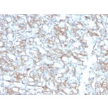 Immunohistochemistry - Anti-PD-L1 Antibody [PDL1/2746] (Biotin) (A251220) - Antibodies.com