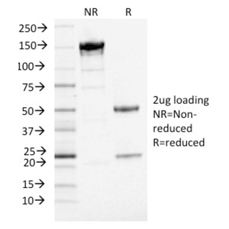 SDS-PAGE - Anti-PD-L1 Antibody [PDL1/2746] (Biotin) (A251220) - Antibodies.com