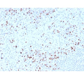 Immunohistochemistry - Anti-Granzyme B Antibody [GZMB/3014] (Biotin) (A251221) - Antibodies.com