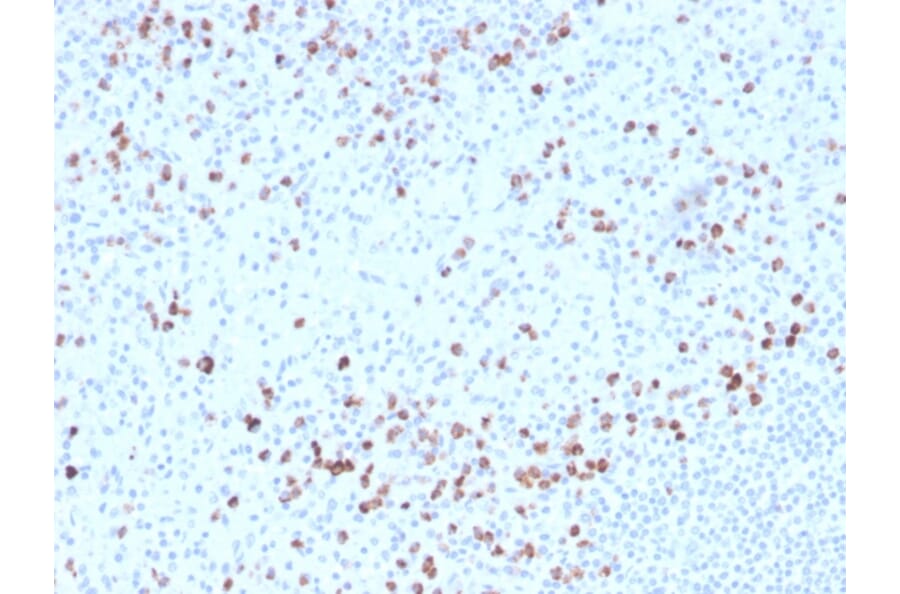 Immunohistochemistry - Anti-Granzyme B Antibody [GZMB/3014] (Biotin) (A251221) - Antibodies.com