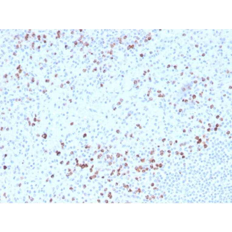 Immunohistochemistry - Anti-Granzyme B Antibody [GZMB/3014] (Biotin) (A251221) - Antibodies.com