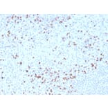 Immunohistochemistry - Anti-Granzyme B Antibody [GZMB/3014] (Biotin) (A251221) - Antibodies.com