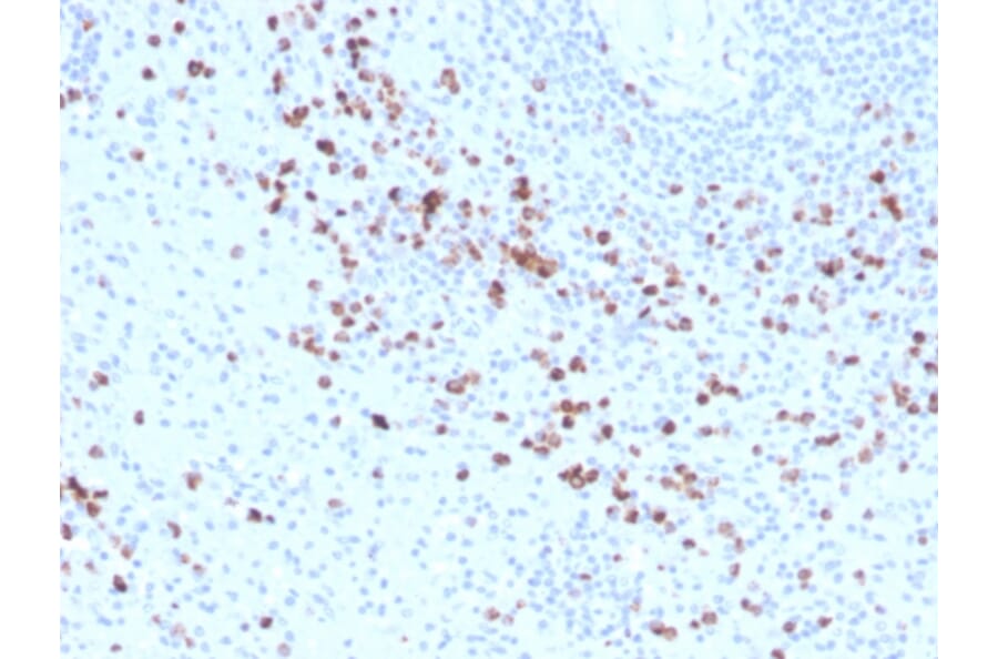 Immunohistochemistry - Anti-Granzyme B Antibody [GZMB/3014] (Biotin) (A251221) - Antibodies.com