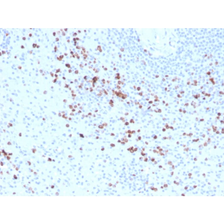 Immunohistochemistry - Anti-Granzyme B Antibody [GZMB/3014] (Biotin) (A251221) - Antibodies.com