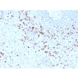 Immunohistochemistry - Anti-Granzyme B Antibody [GZMB/3014] (Biotin) (A251221) - Antibodies.com