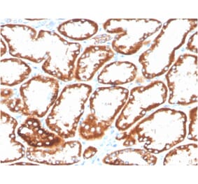 Immunohistochemistry - Anti-CD137 Antibody [4-1BB/3201] (Biotin) (A251222) - Antibodies.com