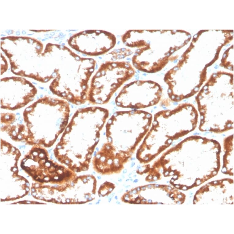 Immunohistochemistry - Anti-CD137 Antibody [4-1BB/3201] (Biotin) (A251222) - Antibodies.com